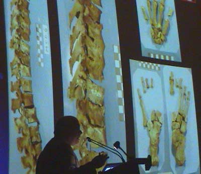 Colonna vertebrale, ossa della mano e del piede di Cosimo I de' Medici